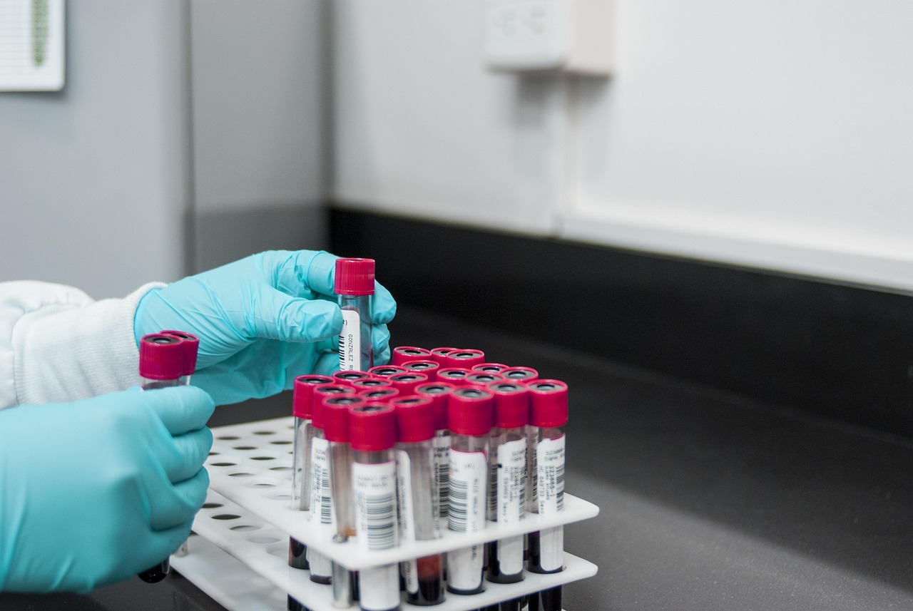lab, experiment, test, chemistry, test tubes, laboratory, hands, gloves, surgical gloves, blood samples, lab, lab, lab, lab, lab, chemistry, laboratory, laboratory, laboratory, laboratory