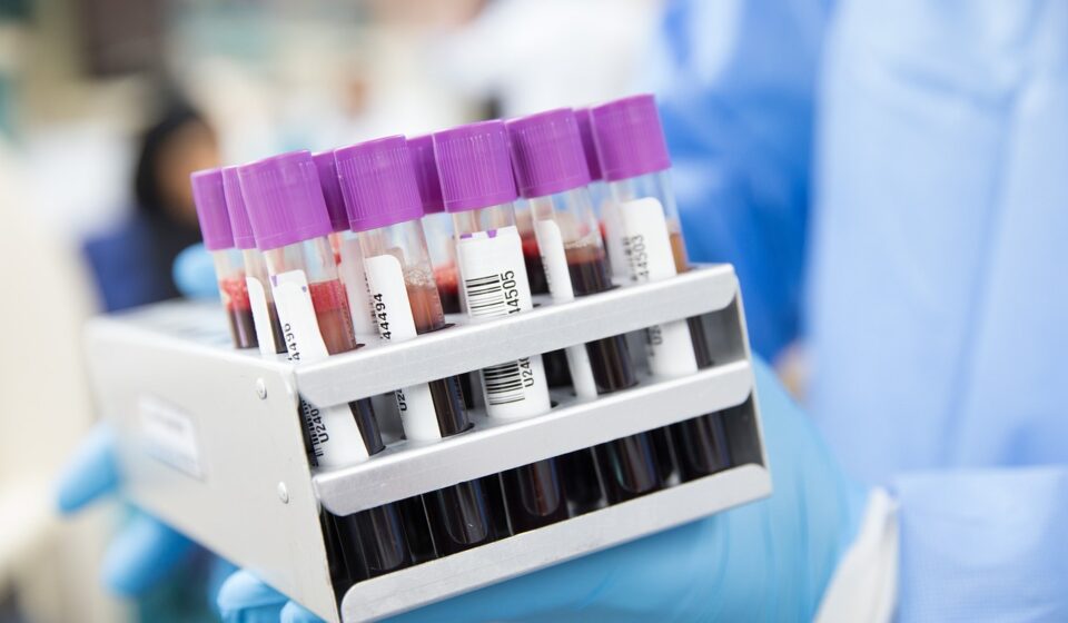 sample, lab, laboratory, scientist, medical, health, test, science, healthcare, research, tube, blue health, blue medical, blue science, blue research, blue lab, blue test, blue blood, blue laboratory, blue healthcare