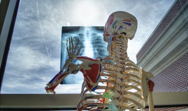 skeleton, medical, technology, medicine, tools, x-ray, skeleton, skeleton, skeleton, x-ray, x-ray, x-ray, x-ray, x-ray