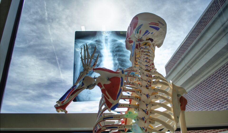 skeleton, medical, technology, medicine, tools, x-ray, skeleton, skeleton, skeleton, x-ray, x-ray, x-ray, x-ray, x-ray
