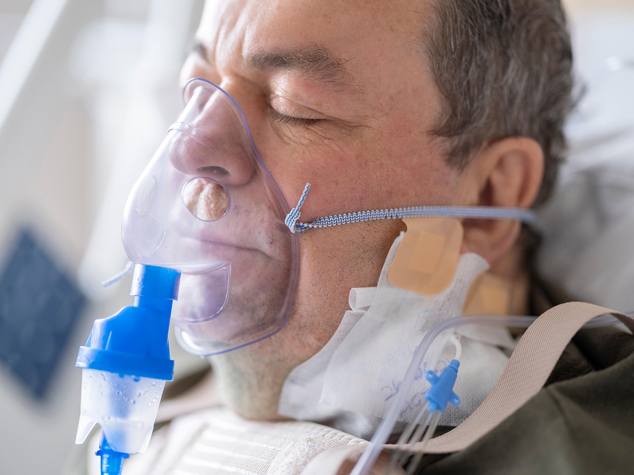 patient, male, oxygen, care, pulse, heart, ecg, rhythm, health, hospital, operation, urgent, life, clinic, biology, medicine, medical, serum, blood pressure