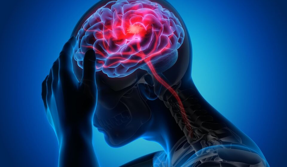 man, woman, migraine, healthcare, health, migraine, migraine, migraine, migraine, migraine