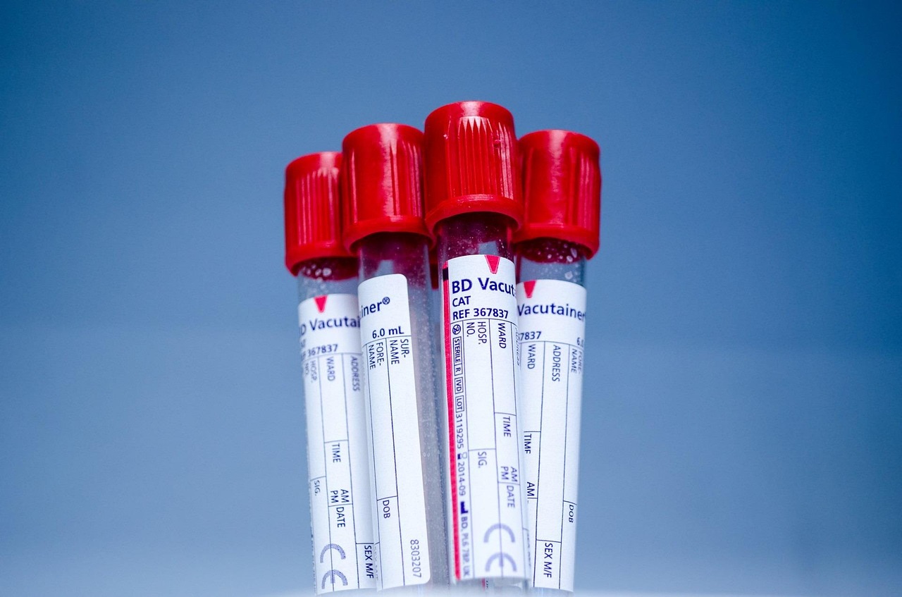 donate, donation, equipment, exam, group, health, hospital, human, lab, label, laboratory, many, medical, medicine, red, research, sample, science, supply, technology, tube, blue health, blue hospital, blue medical, blue research, blue medicine, blue group, blue lab, blue blood, blue laboratory